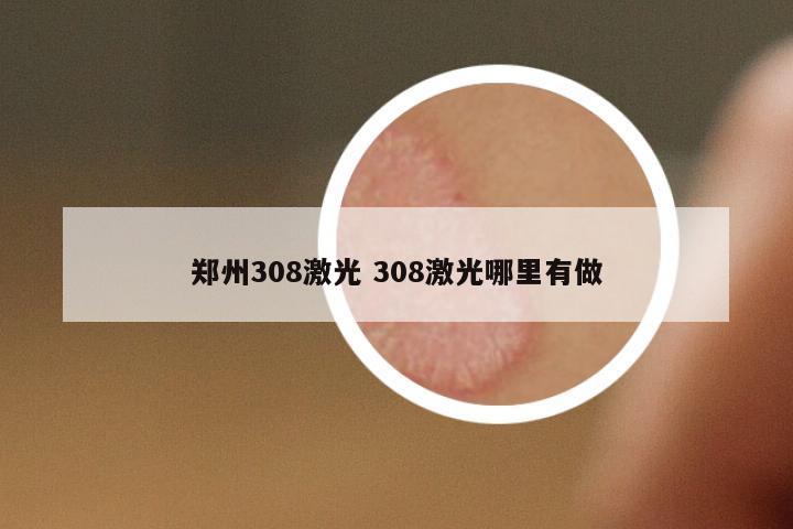 鄭州308激光 308激光哪里有做