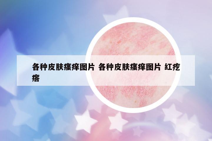 各種皮膚瘙癢圖片 各種皮膚瘙癢圖片 紅疙瘩