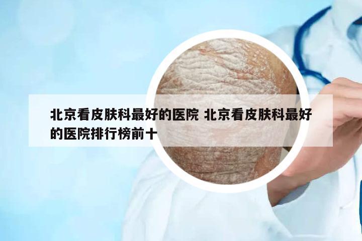 北京看皮膚科最好的醫(yī)院 北京看皮膚科最好的醫(yī)院排行榜前十