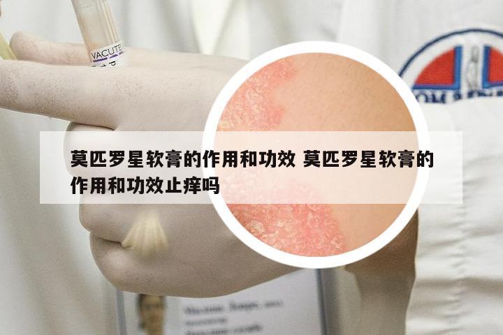 莫匹羅星軟膏的作用和功效 莫匹羅星軟膏的作用和功效止癢嗎