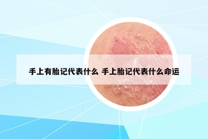 手上有胎記代表什么 手上胎記代表什么命運