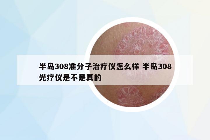半島308準(zhǔn)分子治療儀怎么樣 半島308光療儀是不是真的