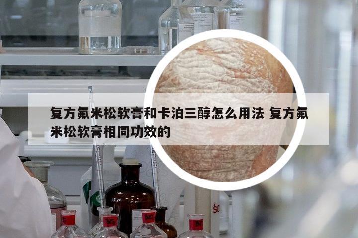 復(fù)方氟米松軟膏和卡泊三醇怎么用法 復(fù)方氟米松軟膏相同功效的