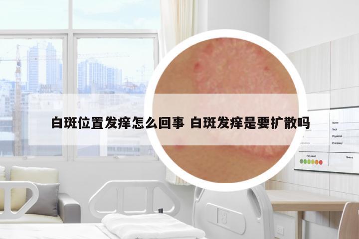 白斑位置發(fā)癢怎么回事 白斑發(fā)癢是要擴(kuò)散嗎