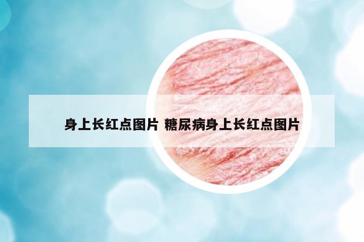 身上長紅點圖片 糖尿病身上長紅點圖片