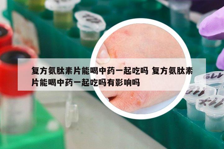 復(fù)方氨肽素片能喝中藥一起吃嗎 復(fù)方氨肽素片能喝中藥一起吃嗎有影響嗎