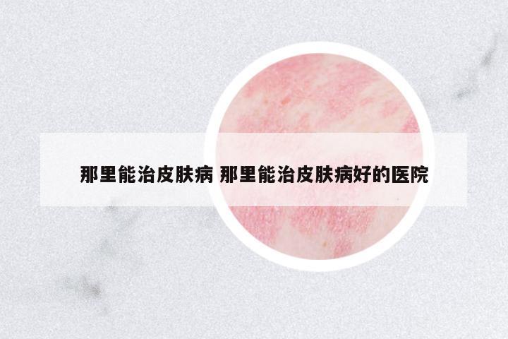 那里能治皮膚病 那里能治皮膚病好的醫(yī)院