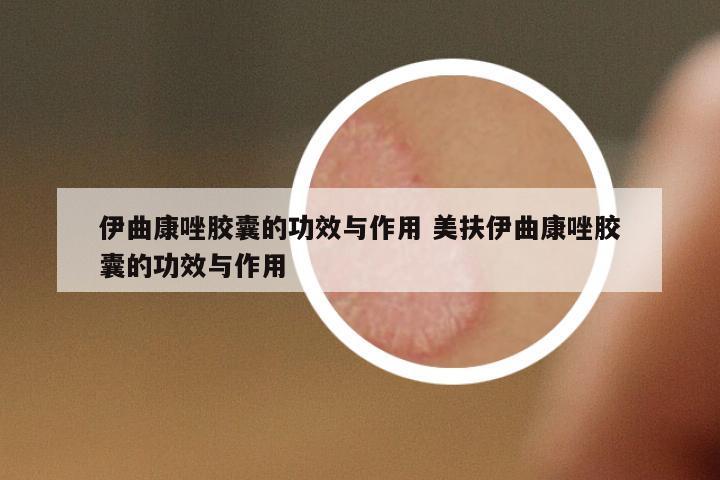 伊曲康唑膠囊的功效與作用 美扶伊曲康唑膠囊的功效與作用