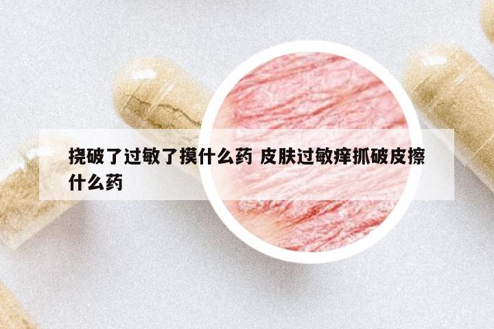 撓破了過敏了摸什么藥 皮膚過敏癢抓破皮擦什么藥