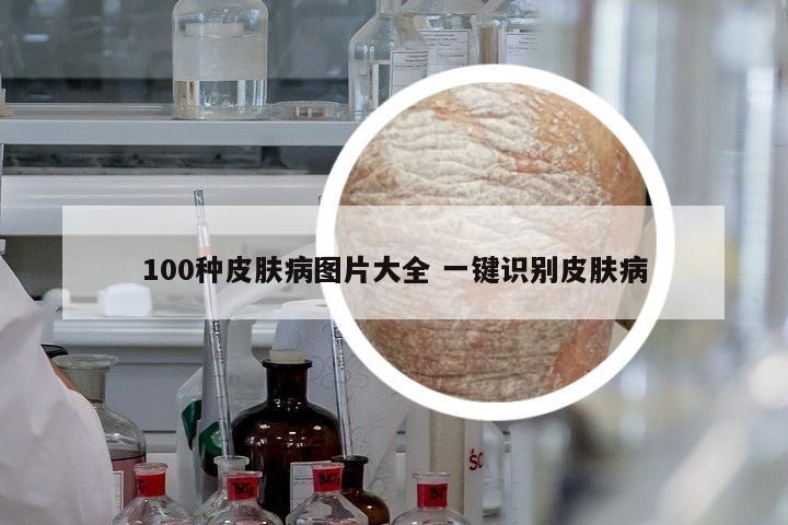 100種皮膚病圖片大全 一鍵識別皮膚病