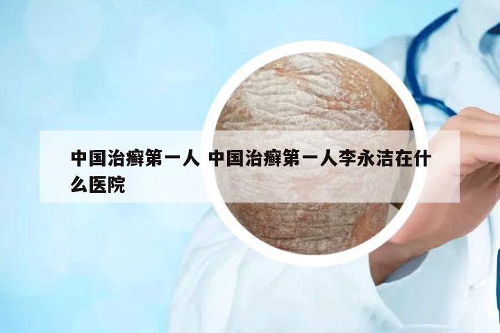 中國治癬第一人 中國治癬第一人李永潔在什么醫(yī)院
