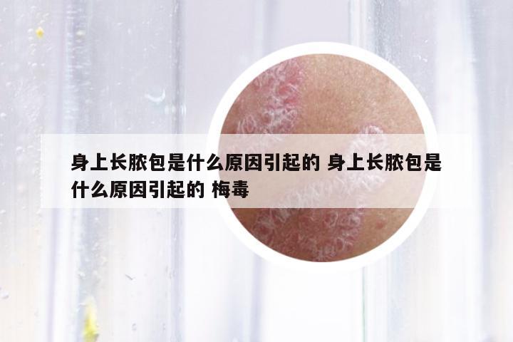 身上長(zhǎng)膿包是什么原因引起的 身上長(zhǎng)膿包是什么原因引起的 梅毒