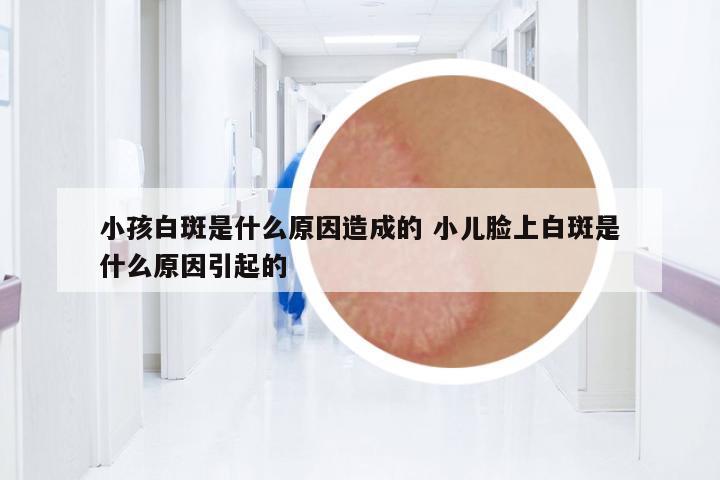小孩白斑是什么原因造成的 小兒臉上白斑是什么原因引起的
