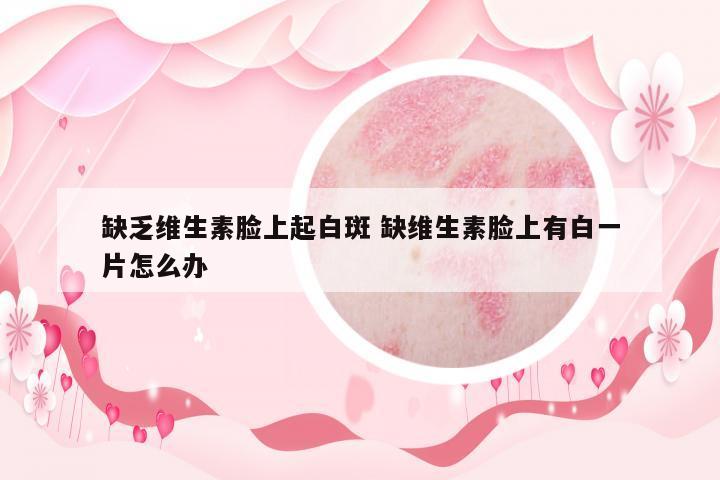 缺乏維生素臉上起白斑 缺維生素臉上有白一片怎么辦