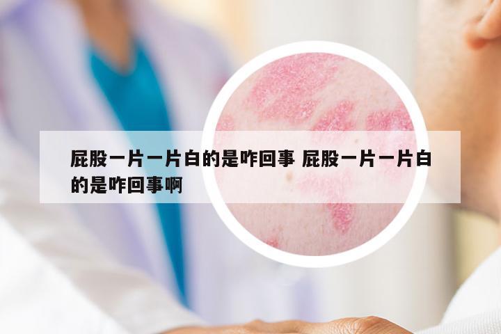 屁股一片一片白的是咋回事 屁股一片一片白的是咋回事啊