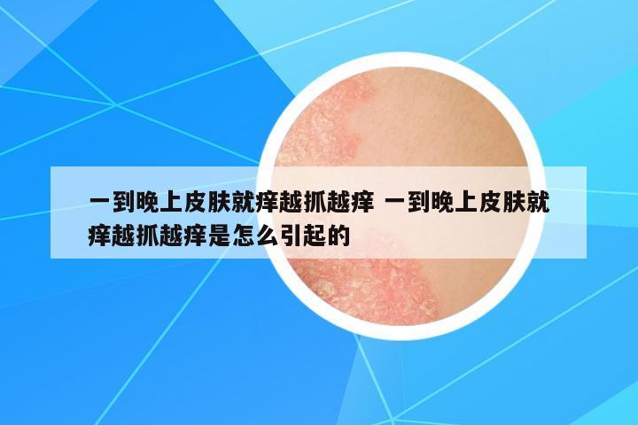 一到晚上皮膚就癢越抓越癢 一到晚上皮膚就癢越抓越癢是怎么引起的