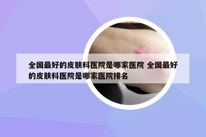 全國最好的皮膚科醫(yī)院是哪家醫(yī)院 全國最好的皮膚科醫(yī)院是哪家醫(yī)院排名
