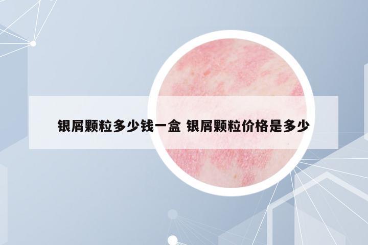 銀屑顆粒多少錢一盒 銀屑顆粒價(jià)格是多少