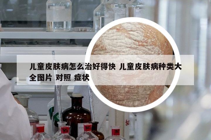 兒童皮膚病怎么治好得快 兒童皮膚病種類大全圖片 對照 癥狀