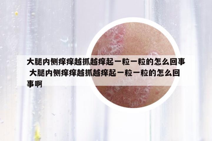 大腿內(nèi)側(cè)癢癢越抓越癢起一粒一粒的怎么回事 大腿內(nèi)側(cè)癢癢越抓越癢起一粒一粒的怎么回事啊