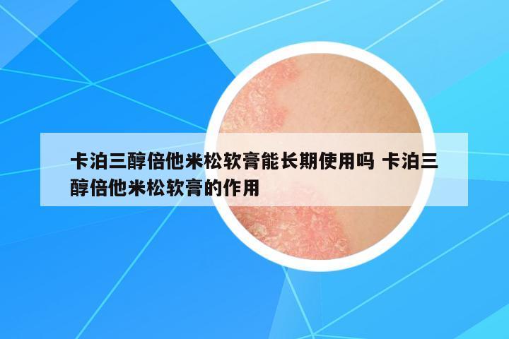 卡泊三醇倍他米松軟膏能長期使用嗎 卡泊三醇倍他米松軟膏的作用