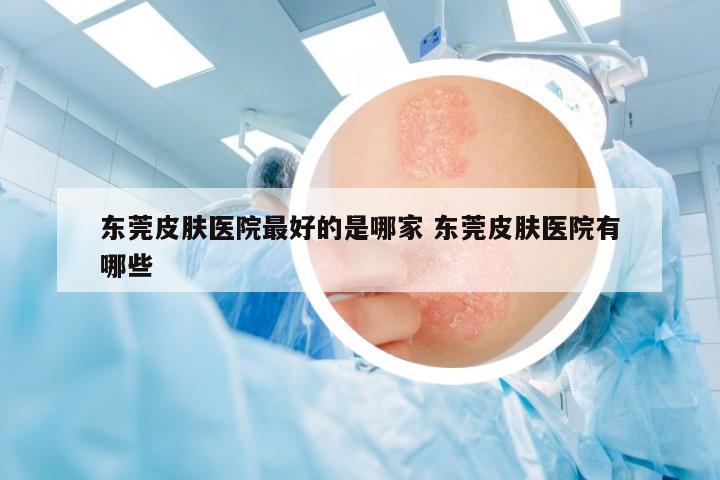 東莞皮膚醫(yī)院最好的是哪家 東莞皮膚醫(yī)院有哪些