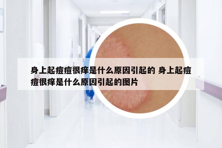 身上起痘痘很癢是什么原因引起的 身上起痘痘很癢是什么原因引起的圖片