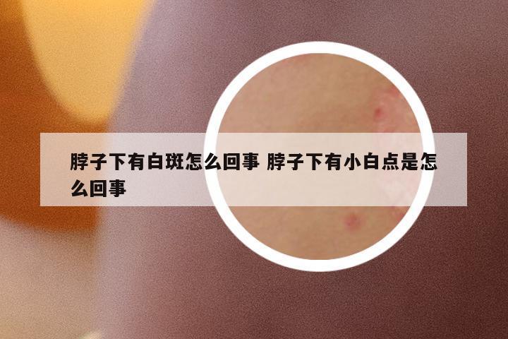 脖子下有白斑怎么回事 脖子下有小白點是怎么回事