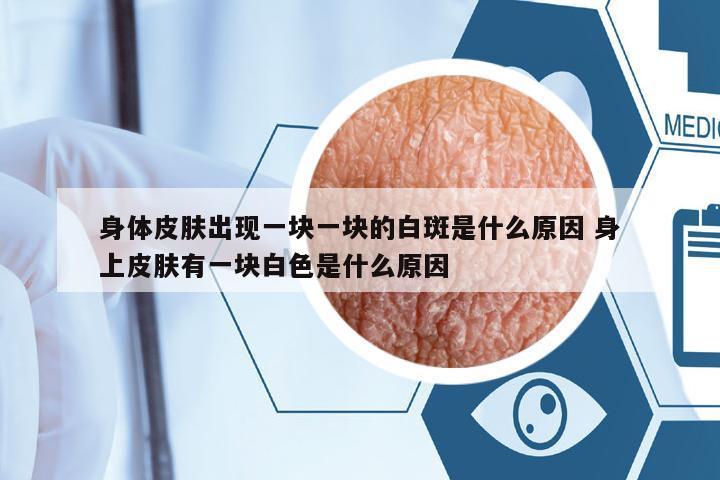 身體皮膚出現(xiàn)一塊一塊的白斑是什么原因 身上皮膚有一塊白色是什么原因