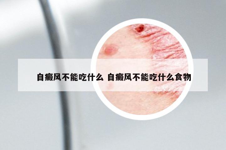 自癜風(fēng)不能吃什么 自癜風(fēng)不能吃什么食物