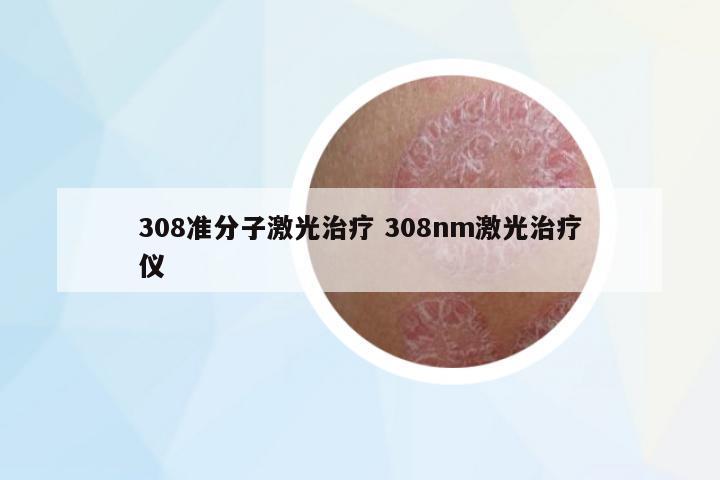 308準(zhǔn)分子激光治療 308nm激光治療儀