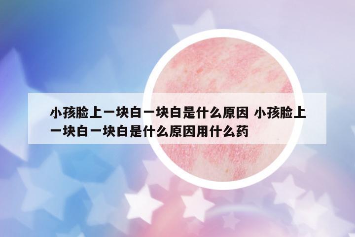 小孩臉上一塊白一塊白是什么原因 小孩臉上一塊白一塊白是什么原因用什么藥