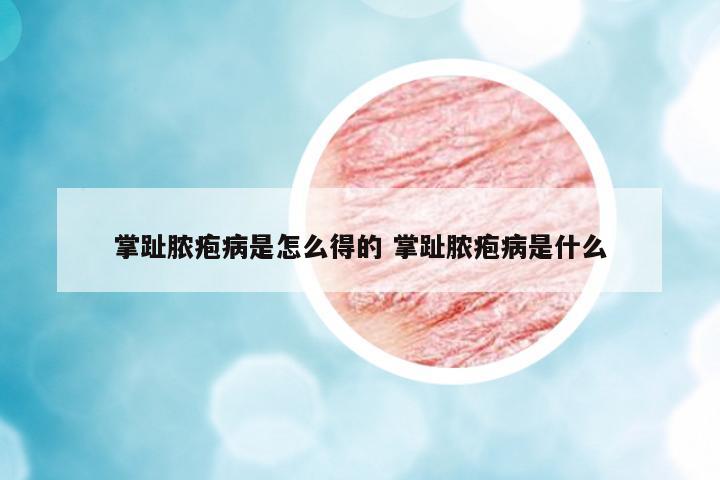 掌趾膿皰病是怎么得的 掌趾膿皰病是什么