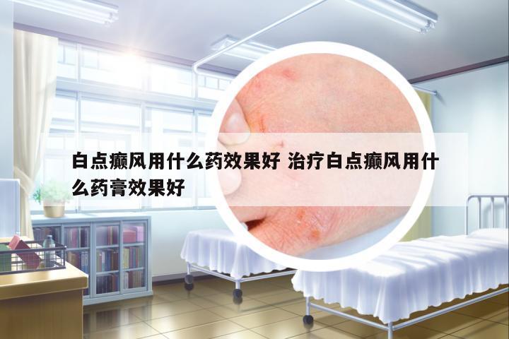 白點(diǎn)癲風(fēng)用什么藥效果好 治療白點(diǎn)癲風(fēng)用什么藥膏效果好