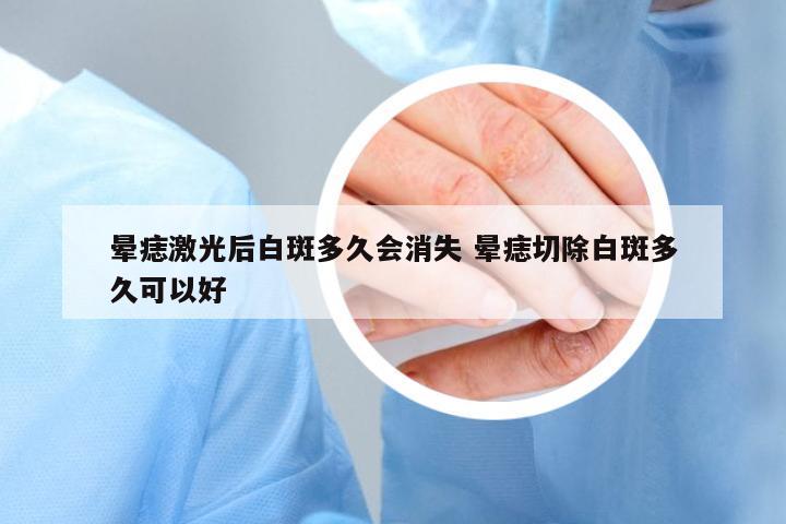 暈痣激光后白斑多久會(huì)消失 暈痣切除白斑多久可以好