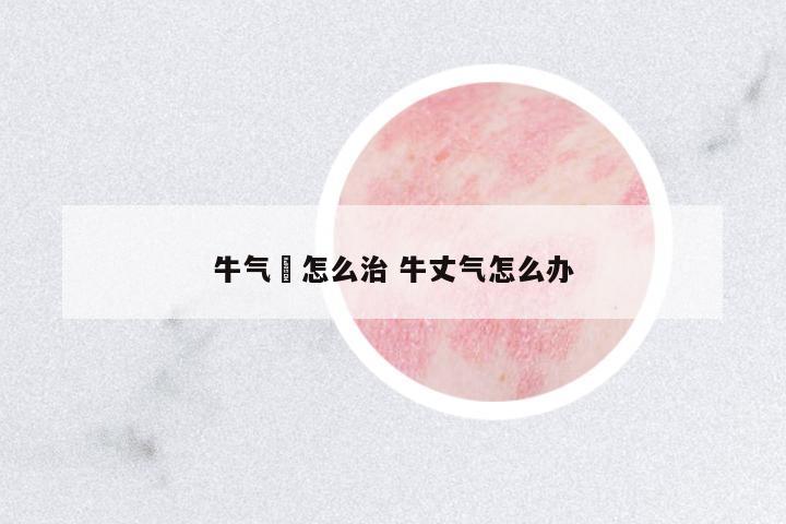 牛氣廯怎么治 牛丈氣怎么辦