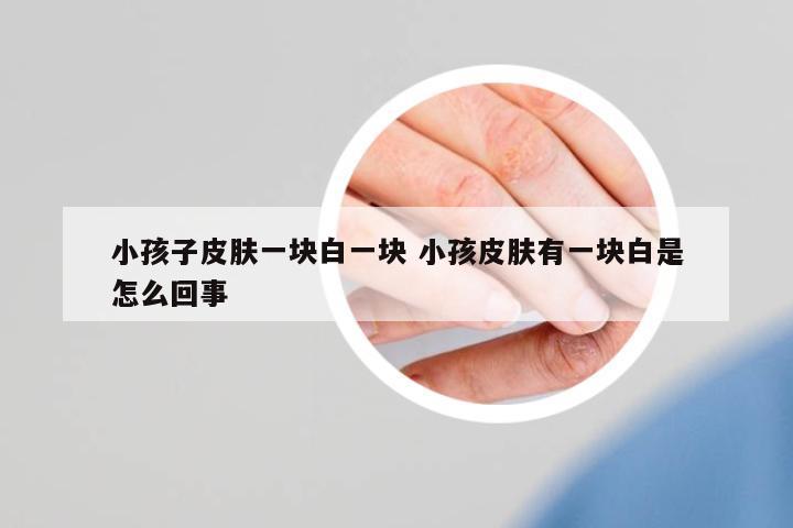 小孩子皮膚一塊白一塊 小孩皮膚有一塊白是怎么回事