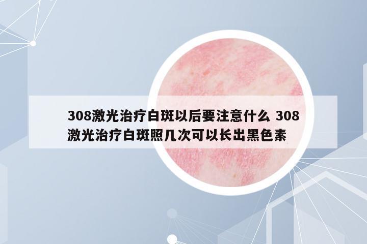 308激光治療白斑以后要注意什么 308激光治療白斑照幾次可以長(zhǎng)出黑色素