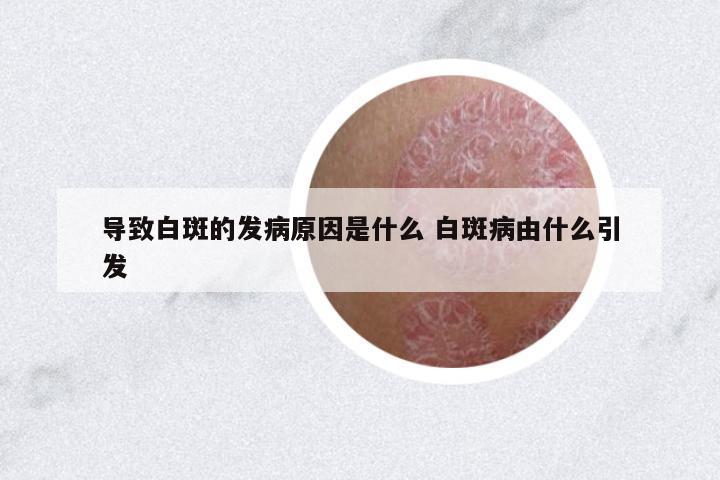 導(dǎo)致白斑的發(fā)病原因是什么 白斑病由什么引發(fā)