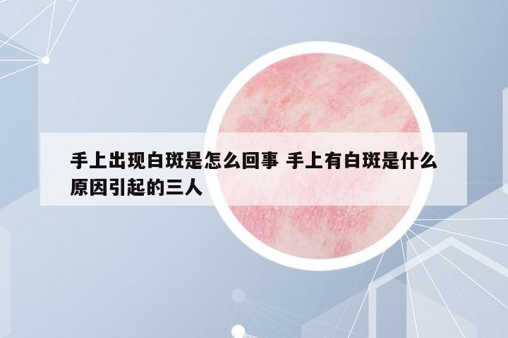 手上出現(xiàn)白斑是怎么回事 手上有白斑是什么原因引起的三人