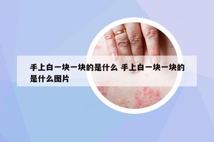手上白一塊一塊的是什么 手上白一塊一塊的是什么圖片