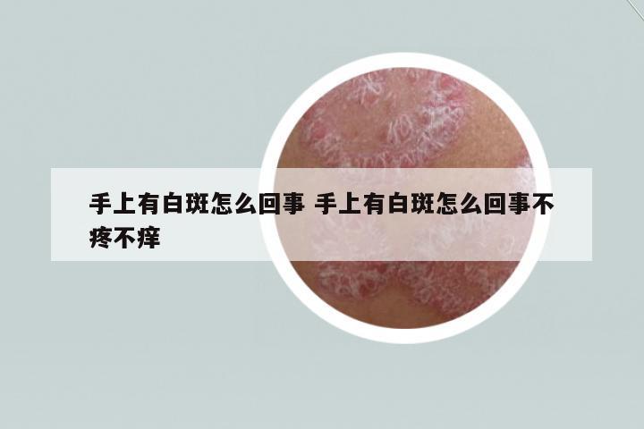手上有白斑怎么回事 手上有白斑怎么回事不疼不癢