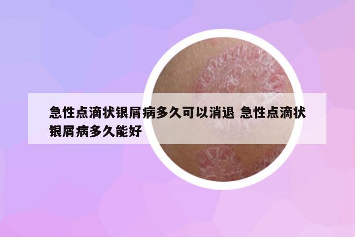 急性點(diǎn)滴狀銀屑病多久可以消退 急性點(diǎn)滴狀銀屑病多久能好