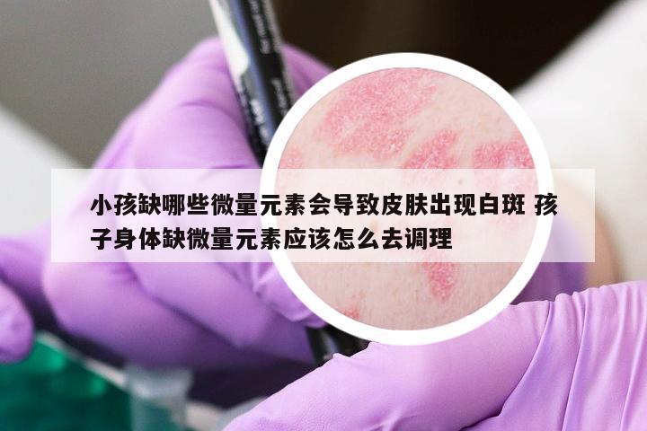 小孩缺哪些微量元素會導(dǎo)致皮膚出現(xiàn)白斑 孩子身體缺微量元素應(yīng)該怎么去調(diào)理