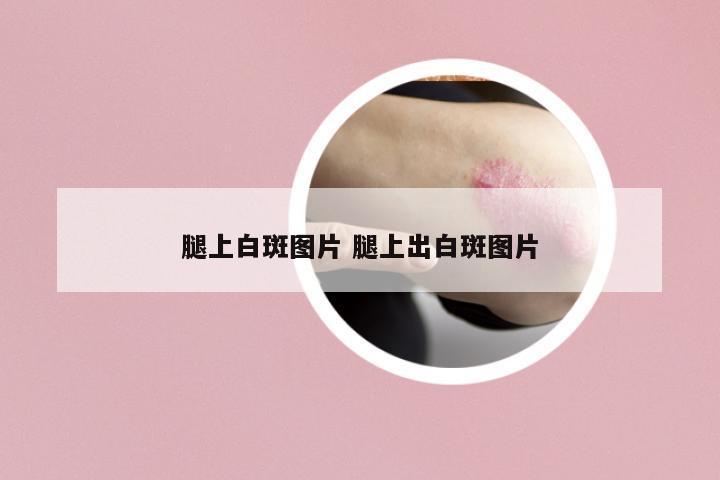 腿上白斑圖片 腿上出白斑圖片