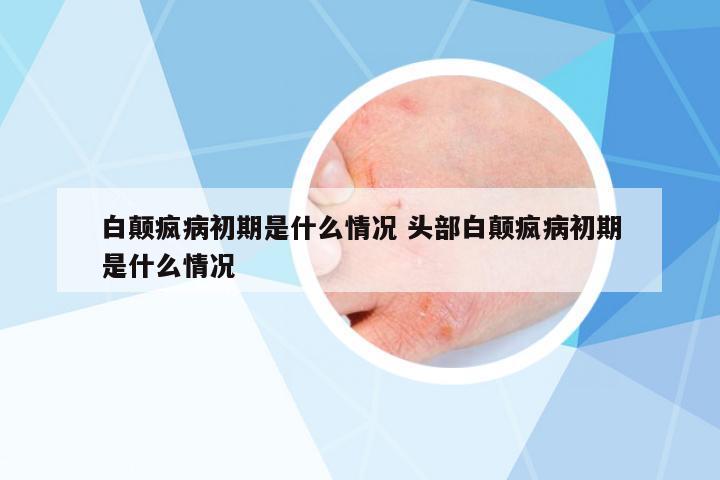 白顛瘋病初期是什么情況 頭部白顛瘋病初期是什么情況