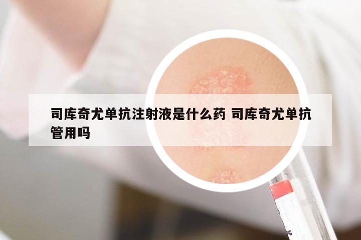 司庫(kù)奇尤單抗注射液是什么藥 司庫(kù)奇尤單抗管用嗎