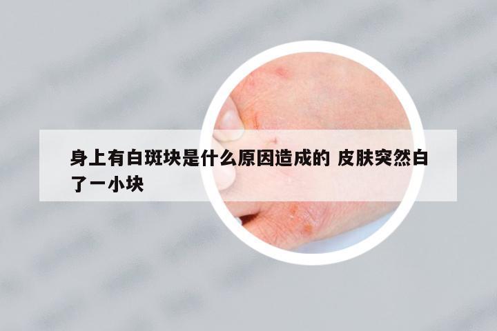 身上有白斑塊是什么原因造成的 皮膚突然白了一小塊