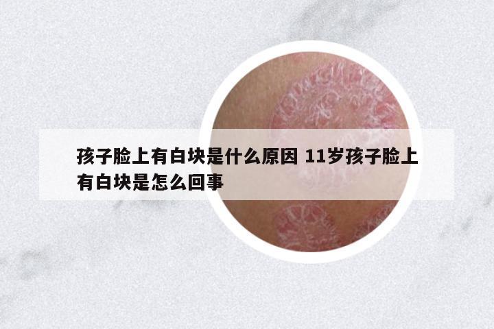 孩子臉上有白塊是什么原因 11歲孩子臉上有白塊是怎么回事