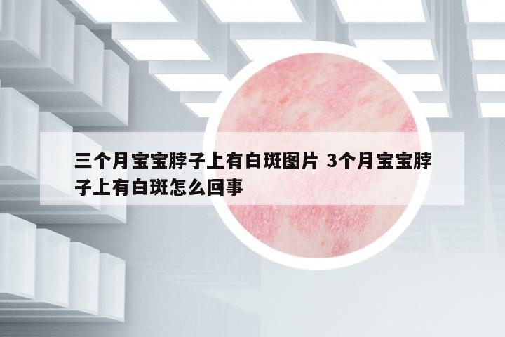 三個(gè)月寶寶脖子上有白斑圖片 3個(gè)月寶寶脖子上有白斑怎么回事